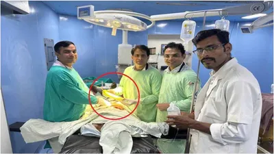 madhya pradesh  doctors extract 16 inch bottle gourd from man’s rectum after 2 hour surgery