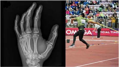 neeraj chopra reveals he participated in diamond league final with a broken hand