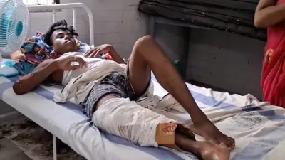 bihar health centre under fire for using cardboard to  plaster  man s fractured leg