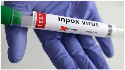 india reports first confirmed case of mpox virus in haryana  what you need to know